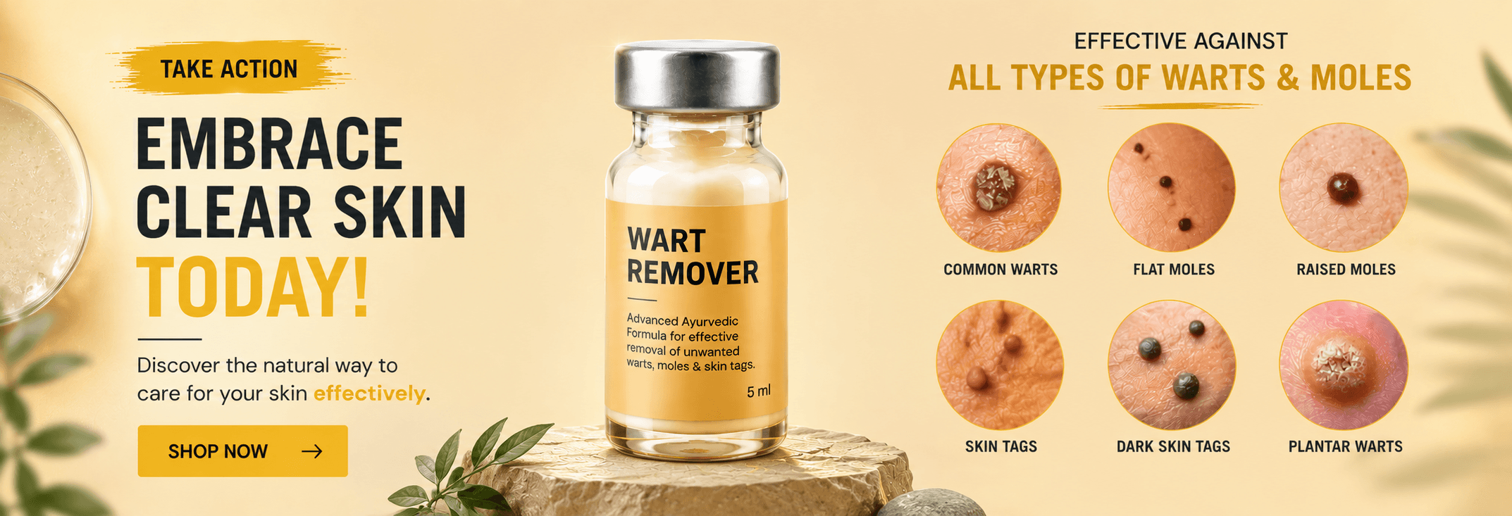 Best Wart remover Cream