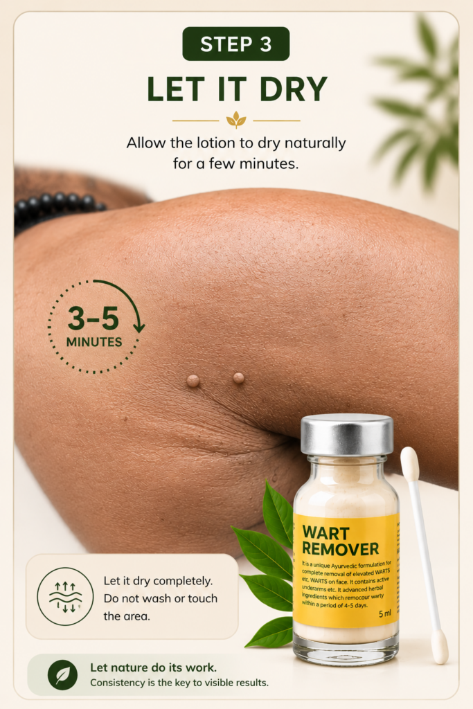 Best Wart remover Cream